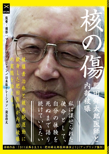 核の傷:肥田舜太郎医師と内部被曝